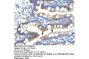 Human Intestine (CLIC5 抗体  (Middle Region))