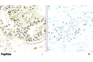 Immunohistochemistry analysis of paraffin-embedded human testis tissue using DYNLRB2 polyclonal antibody . (DYNLRB2 抗体)