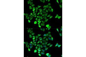 Immunofluorescence analysis of HeLa cell using KCNN4 antibody. (KCNN4 抗体  (AA 288-427))