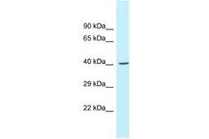 Image no. 1 for anti-Glycine C-Acetyltransferase (GCAT) (AA 219-268) antibody (ABIN6747617) (GCAT 抗体  (AA 219-268))