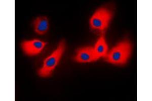 Immunofluorescence (IF) image for anti-Cytochrome P450, Family 2, Subfamily A, Polypeptide 6 (CYP2A6) (N-Term) antibody (ABIN7299210)