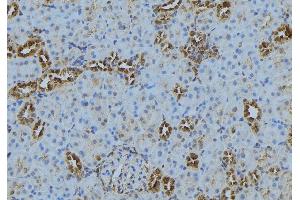 ABIN6272875 at 1/100 staining Mouse kidney tissue by IHC-P. (CAMSAP2 抗体  (C-Term))