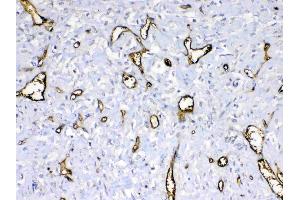 Immunohistochemistry (IHC) image for anti-Hemoglobin, delta (HBd) (AA 2-147) antibody (ABIN5518999)