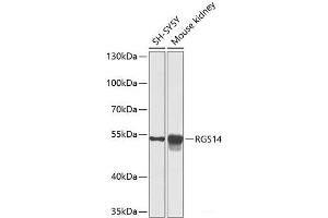 Western blot analysis of extracts of various cell lines using RGS14 Polyclonal Antibody at dilution of 1:1000. (RGS14 抗体)