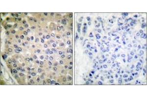 Immunohistochemistry (IHC) image for anti-Protein Phosphatase 1, Regulatory (Inhibitor) Subunit 14A (PPP1R14A) (pThr38) antibody (ABIN2888390) (CPI-17 抗体  (pThr38))