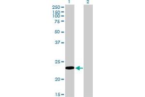 Western Blot analysis of RBP4 expression in transfected 293T cell line by RBP4 monoclonal antibody (M01), clone 1E9. (RBP4 抗体  (AA 19-201))