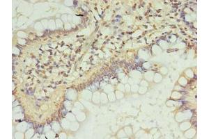 Immunohistochemistry of paraffin-embedded human small intestine tissue using ABIN7151719 at dilution of 1:100 (ZC3H12A 抗体  (AA 1-260))