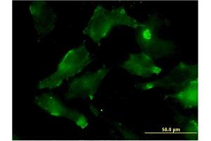 Immunofluorescence of monoclonal antibody to HSD17B7 on HeLa cell. (HSD17B7 抗体  (AA 255-341))