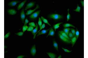 Immunofluorescence staining of A549 cells with ABIN7146551 at 1:166, counter-stained with DAPI. (Calpastatin 抗体  (AA 1-667))