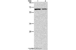 Western blot analysis of Mouse pancreas and human fetal liver tissue, using CBS Polyclonal Antibody at dilution of 1:550 (CBS 抗体)