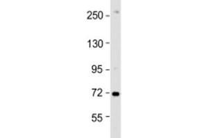 Western blot testing of HeLa cell lysate with ZDHHC17 antibody at 1:1000. (ZDHHC17 抗体  (AA 3-37))