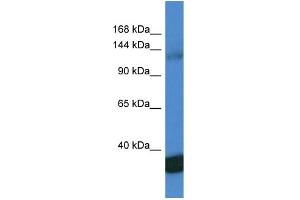 WB Suggested Anti-PPP1R12A AntibodyTitration: 1. (PPP1R12A 抗体  (C-Term))