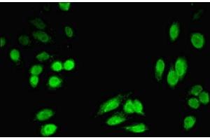 Immunofluorescent analysis of HepG2 cells using ABIN7142468 at dilution of 1:100 and Alexa Fluor 488-congugated AffiniPure Goat Anti-Rabbit IgG(H+L) (HPD 抗体  (AA 2-393))