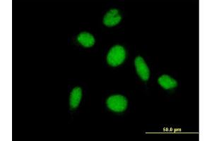 Immunofluorescence of purified MaxPab antibody to PIAS2 on HeLa cell.