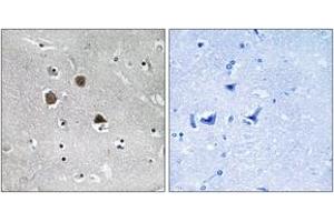 anti-MAP/microtubule Affinity-Regulating Kinase 1/2/3/4 (MARK1/2/3/4) (AA 181-230) antibody
