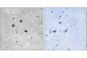 Immunohistochemistry analysis of paraffin-embedded human brain tissue, using MARK1/2/3/4 (Ab-215) Antibody. (MARK1/2/3/4 抗体  (AA 181-230))