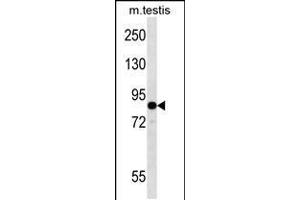 Western blot analysis in mouse testis tissue lysates (35ug/lane). (EIF2B5 抗体  (N-Term))