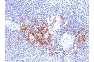 Formalin-fixed, paraffin-embedded human Spleen stained with TRAF1 Mouse Monoclonal Antibody (TRAF1/2770). (TRAF1 抗体  (AA 73-219))