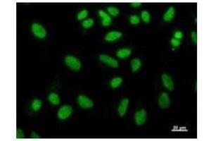 Immunostaining analysis in HeLa cells. (NAB1 抗体)