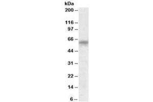 Western blot testing of human testis lysate with TTC8 antibody at 0. (TTC8 抗体)