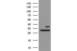 Western Blotting (WB) image for anti-Proteasome (Prosome, Macropain) Subunit, beta Type, 7 (PSMB7) (AA 58-277) antibody (ABIN1491600) (PSMB7 抗体  (AA 58-277))