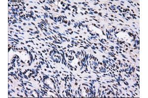 Immunohistochemical staining of paraffin-embedded colon tissue using anti-GBE1mouse monoclonal antibody. (GBE1 抗体)
