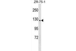Western Blotting (WB) image for anti-Phosphatidylinositol Transfer Protein, Membrane-Associated 1 (PITPNM1) antibody (ABIN2999313) (PITPNM1 抗体)