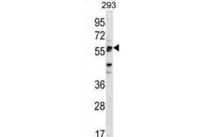 Western Blotting (WB) image for anti-Sialic Acid Binding Ig-Like Lectin 6 (SIGLEC6) antibody (ABIN2998617) (SIGLEC6 抗体)