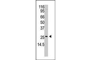 Western blot analysis of APH1A polyclonal antibody  in A2058 cell lysate (35 ug/lane). (APH1A 抗体  (N-Term))