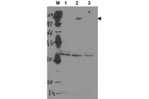 Image no. 1 for anti-Tumor Protein P53 Binding Protein 2 (TP53BP2) antibody (ABIN401045) (TP53BP2 抗体)