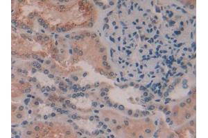 DAB staining on IHC-P; Samples: Human Kidney Tissue (AMBP 抗体  (AA 22-203))