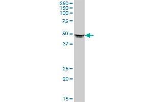 Western Blotting (WB) image for anti-Dihydrolipoamide S-Succinyltransferase (E2 Component of 2-Oxo-Glutarate Complex) (DLST) (AA 1-453) antibody (ABIN515000)