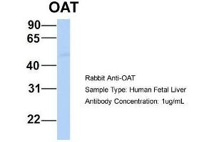 Host:  Rabbit  Target Name:  OAT  Sample Type:  Human Fetal Liver  Antibody Dilution:  1. (OAT 抗体  (Middle Region))