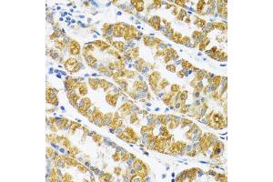 Immunohistochemistry of paraffin-embedded human stomach using POLG2 antibody (ABIN5974040) at dilution of 1/100 (40x lens). (POLG2 抗体)