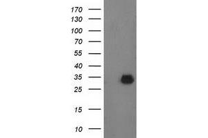 Western Blotting (WB) image for anti-Phenylethanolamine N-Methyltransferase (PNMT) antibody (ABIN1500309) (PNMT 抗体)