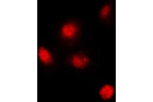 Immunofluorescent analysis of SUPT3H staining in MCF7 cells. (SUPT3H/SPT3 抗体  (Center))