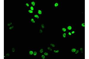 Immunofluorescence staining of PC-3 cells with ABIN7164186 at 1:133, counter-stained with DAPI. (XAB2 抗体  (AA 750-840))