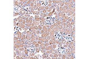 IHC analysis of p57 Kip2/CDKN1C using anti-p57 Kip2/CDKN1C antibody (ABIN7603232). (CDKN1C 抗体  (N-Term))