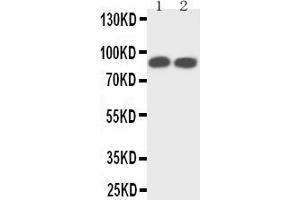 Anti-TrkA antibody, Western blotting Lane 1: Rat Brain Tissue Lysate Lane 2: Mouse Brain Tissue Lysate