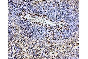 IHC analysis of CD43 using anti-CD43 antibody (ABIN7601042). (CD43 抗体  (AA 272-400))