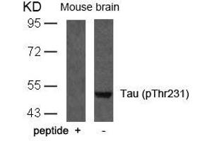 Western blot analysis of extracts from mouse brain tissue using Tau(Phospho-Thr231) Antibody and the same antibody preincubated with blocking peptide. (MAPT 抗体  (pThr231))