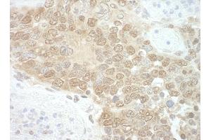 Immunohistochemistry (IHC) image for anti-RuvB-Like 2 (E. Coli) (RUVBL2) (AA 1-50) antibody (ABIN7448783) (RUVBL2 抗体  (AA 1-50))