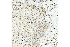 Immunohistochemistry (IHC) image for anti-Ligase III, DNA, ATP-Dependent (LIG3) (AA 730-1009) antibody (ABIN6143207)