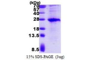 SDS-PAGE (SDS) image for V-Set and Transmembrane Domain Containing 2 Like (VSTM2L) (AA 25-204) protein (His tag) (ABIN6386879)