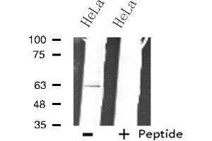 Western blot analysis of extracts from HeLa cells, using ZNF18 antibody. (ZNF18 抗体  (C-Term))