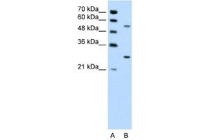 WB Suggested Anti-PDPK1 Antibody Titration: 0.