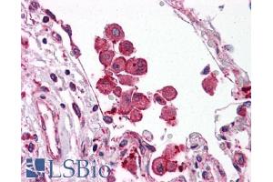 Image no. 2 for anti-Toll-Like Receptor 8 (TLR8) (C-Term) antibody (ABIN605181) (TLR8 抗体  (C-Term))