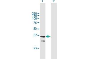 Western Blot analysis of AGMAT expression in transfected 293T cell line by AGMAT MaxPab polyclonal antibody. (AGMAT 抗体  (AA 1-352))