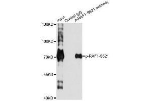 Immunoprecipitation analysis of 200 μg extracts of HeLa cells treated by EGF using 2. (RAF1 抗体  (pSer621))