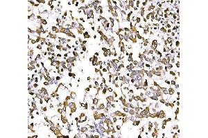 IHC analysis of GGA3 using anti-GGA3 antibody (ABIN7602337).
